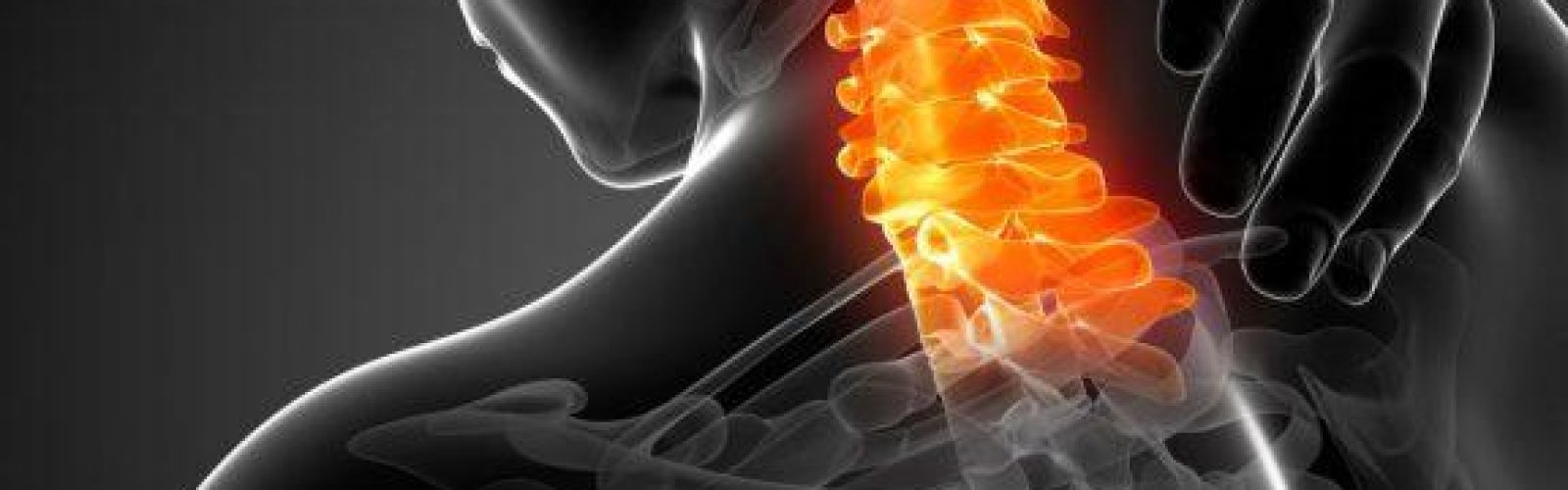 fisioterapia-en-barrio-salamanca-impacto-cervical
